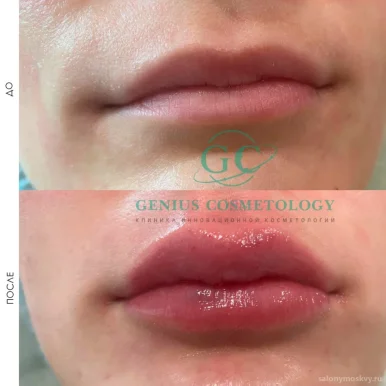 Клиника косметологии Genius Cosmetology фото 18